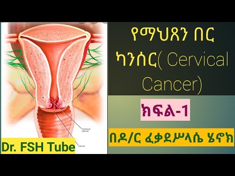 የማህጸን በር(ጫፍ) ካንሰር (Cervical Cancer) ክፍል-1