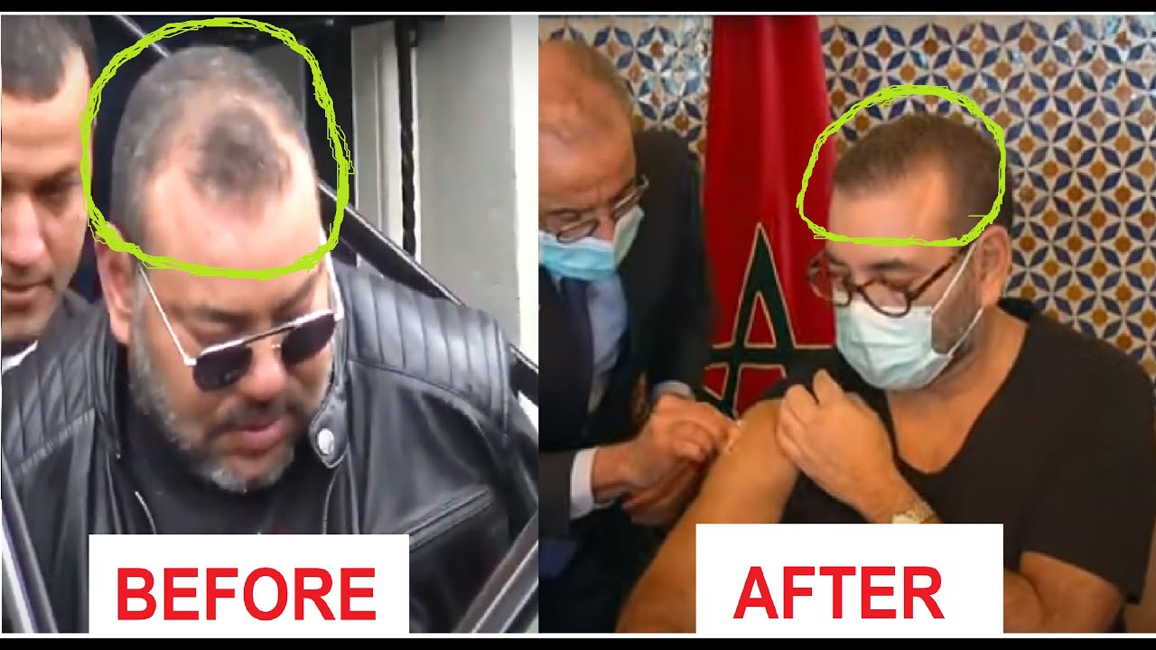 MAROC - MOROCCO Le cerveau de ton bourreau est dans c cheveux إلى العبيد: دماغ جلادك في شعره- المغرب