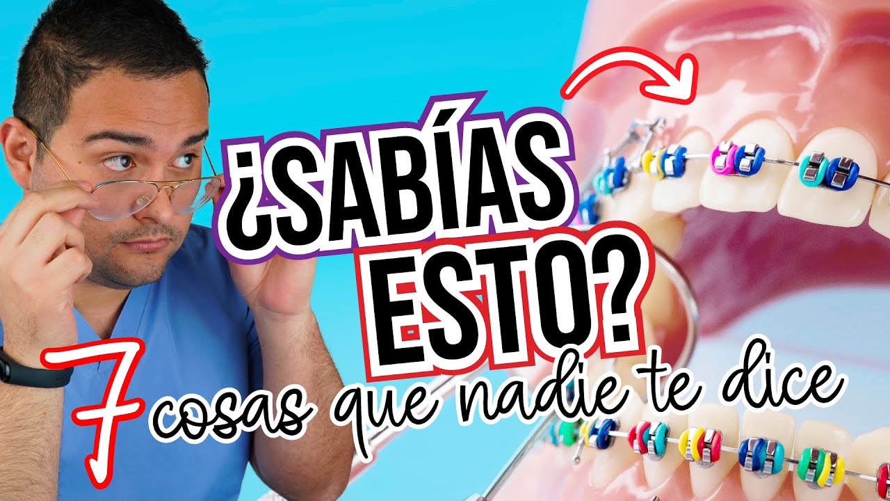 Lo que NADIE TE DICE ? de ponerte BRACKETS / ORTODONCIA ?