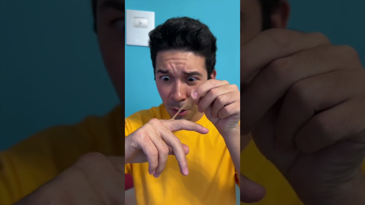 ERICK SI È FATTO MALE TOGLIENDO UNA PELLICINA… ?#shorts